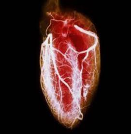 پاسخگویی  به سوالات رایج در خصوص نارسایی قلبی (2)